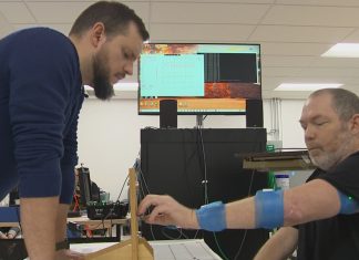Experimental brain implant helps stroke survivor regain arm function