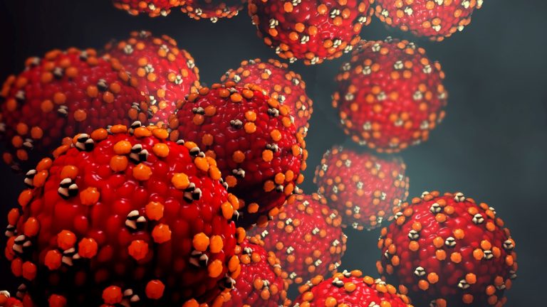 Snohomish County sees measles outbreak